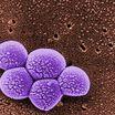 methicillin resistant Staphylococcus aureus