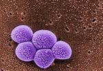 methicillin resistant Staphylococcus aureus