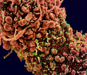 Human cells infected with SARS-CoV-2 virus